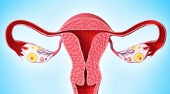 如何避免卵巢早衰，提前预防是关键，几个保养卵巢的好习惯。